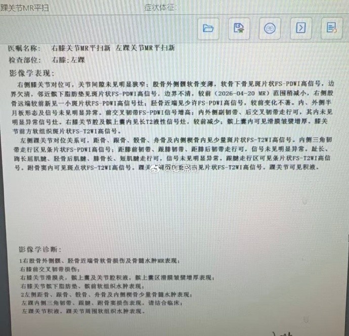 右膝前交叉韧带损伤 高诗岩赴美康复 右膝前交叉韧带损伤 高诗岩赴美康复